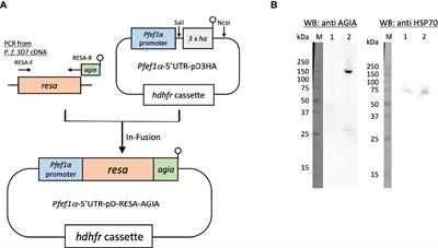 AGIA Tag System for Ultrastructural Protein Localization Analysis in Blood-Stage Plasmodium falciparum